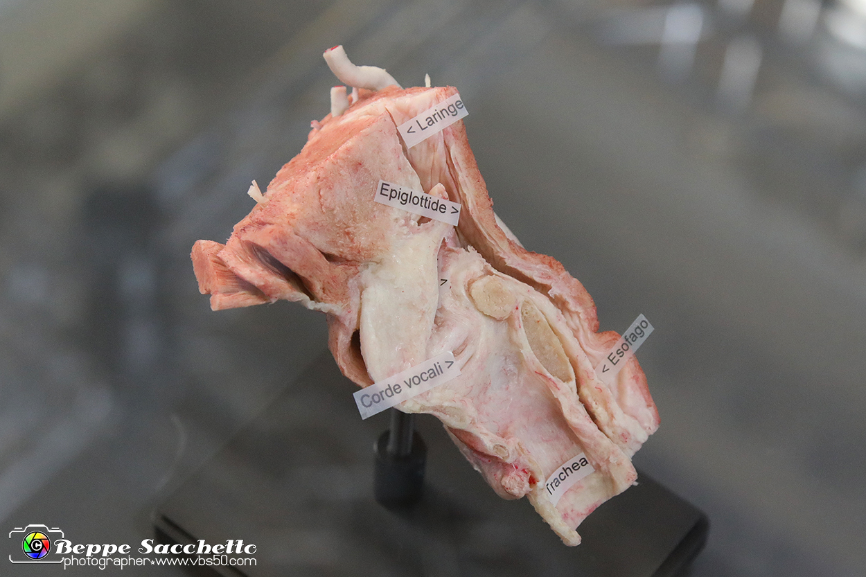 VBS_2654 - Laringe - Mostra Body Worlds.jpg
